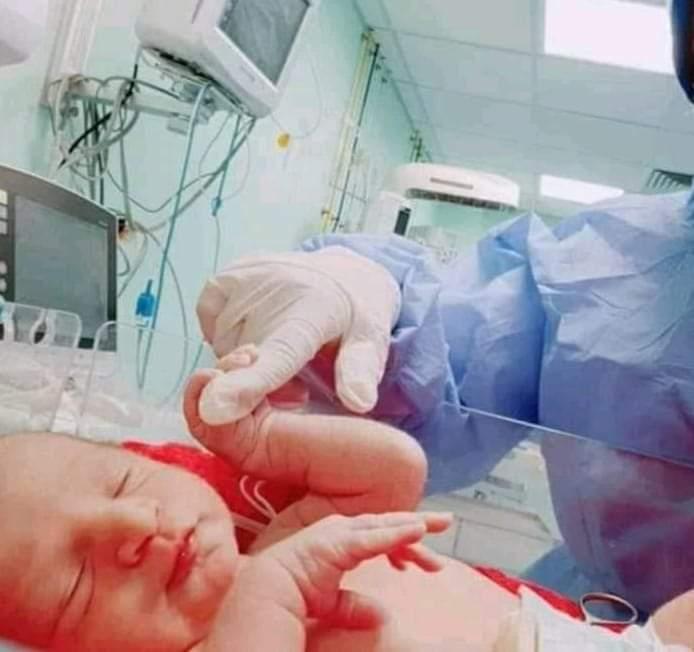 نجاح اول عملية  ولادة لطفل امه   مصابة بالكورونا بمستشفى الاقصر العام للعزل
