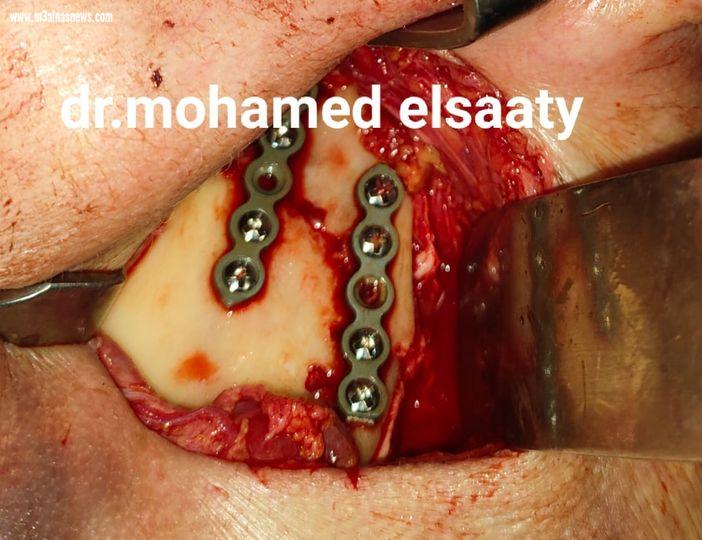 سعي صحة الدقهلية لتوفيرالخدمات والجراحات الطبية الدقيقة بكافة التخصصات بمستشفياتها.