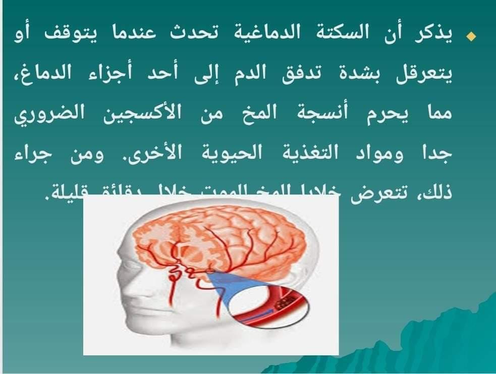 تمريض حلوان تقدم ١٤ نصيحة لمرضى السكتة الدماغية في رمضان 