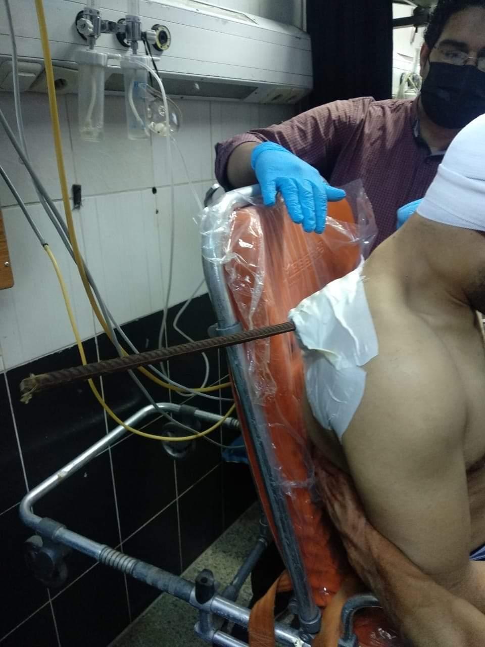 استخراج سيخ حديد اخترق الرئة اليسرى بمستشفى الطوارئ بجامعة المنصورة 
