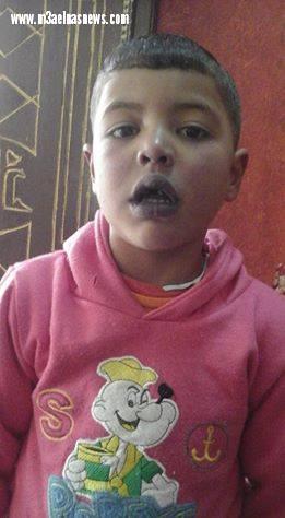 استجابة لما نشرناه| «إيمن عبدالله » مع طفل القلب فى رئاسة هيئة التأمين الصحي بالقاهرة 