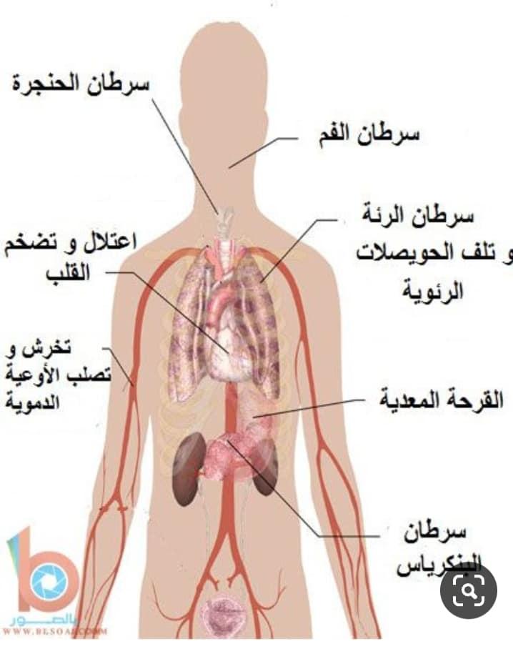 علماء الصحة يطالبون بعلانية الاجتماع التاسع لمؤتمر أطراف اتفاقية مكافحة التبغ