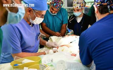 في عملية مدتها 7 ساعات.. نجاح فصل توأم سيامي سعودي