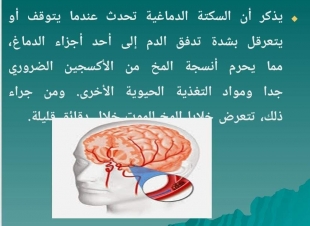 تمريض حلوان تقدم ١٤ نصيحة لمرضى السكتة الدماغية في رمضان 