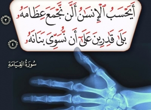 ايحسب الانسان ان يترك سدي